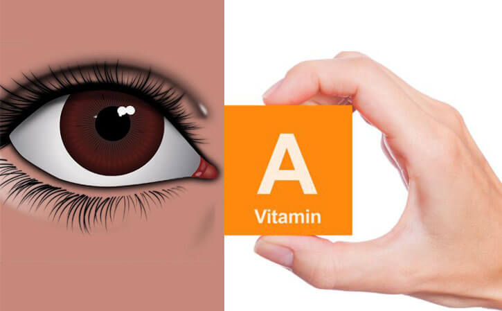 what is vitamin A